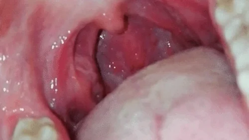 Miss Pretty Mouth - Vore Valentine's Day