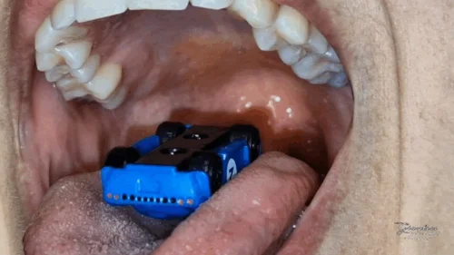 Giantess Yellow Ball - Micro machines inside a giantess mouth
