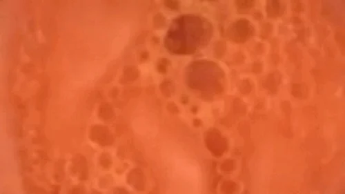 Nicoletta Embassi - FullScreen exploration with pillcam from the doctor to the beauty center 720MP4