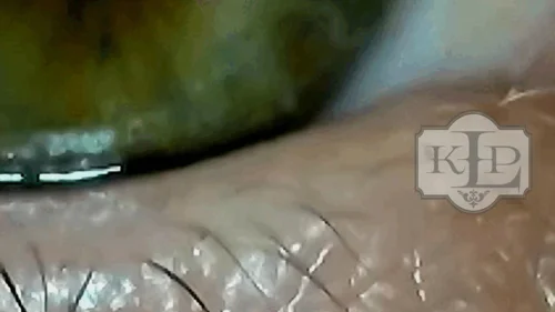 Ladykassandra - Up Close Look at my Enormous Eye
