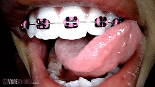 Oralvore - Naomi Braces Endoscopic Tour 720 HD POV Giantess Vore