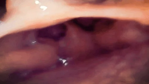Nicoletta Embassi - A Journey into the Depths: Exploring My Gut with PillCam, Through Sounds and Images of a Hidden World 720HD