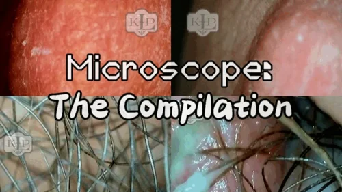 Ladykassandra - Microscope: The Compilation