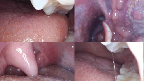 Giantess Yellow Ball - Inside a giantessElly mouth